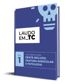 ebook_dente_incluso_fratura_radicular_patologia_llradiologia